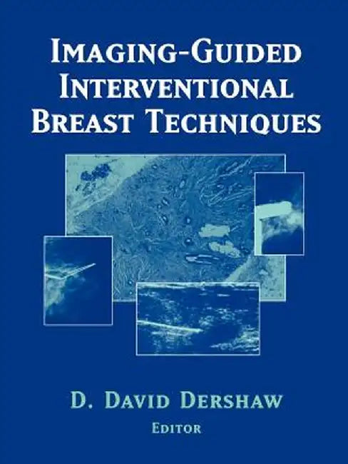 Imaging-Guided Interventional Breast Techniques by David D. Dershaw