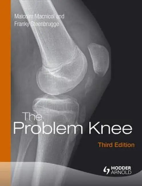 The Problem Knee by Malcolm F. MacNicol