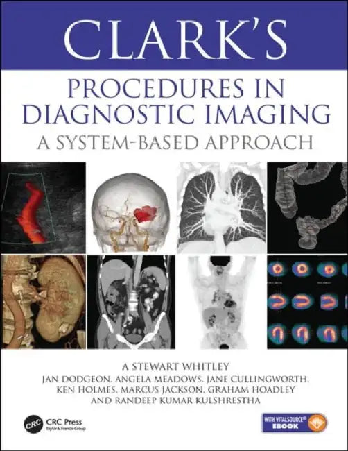 Clark’s Procedures in Diagnostic Imaging by A Stewart Whitley