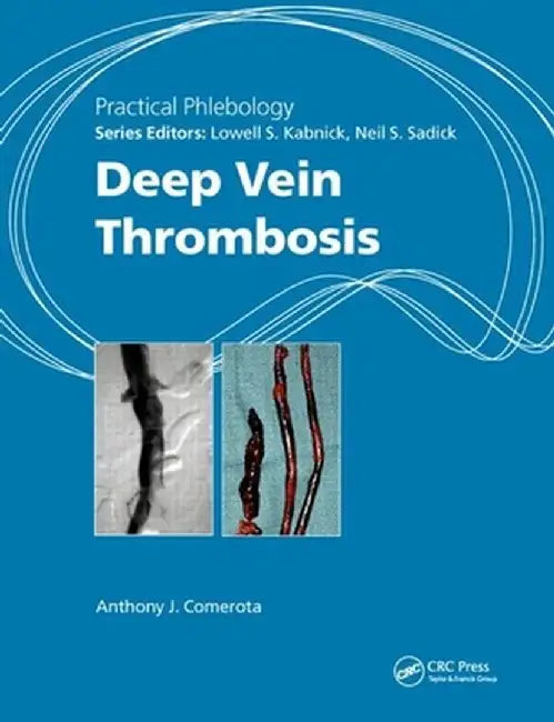Deep Vein Thrombosis by Anthony J. Comerota
