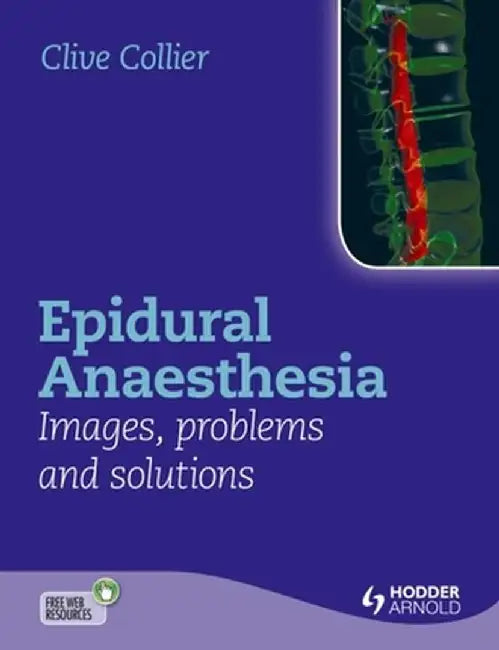 Epidural Anaesthesia: Images, Problems and Solutions by Clive Collier