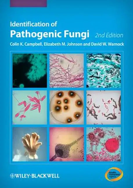 Identification of Pathogenic Fungi by Colin K. Campbell