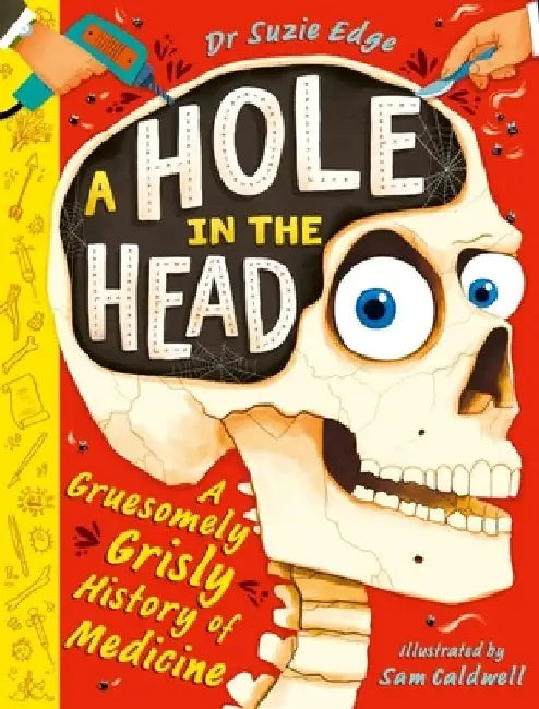 A Hole in the Head: A gruesomely grisly history of medical firsts by Suzie Edge