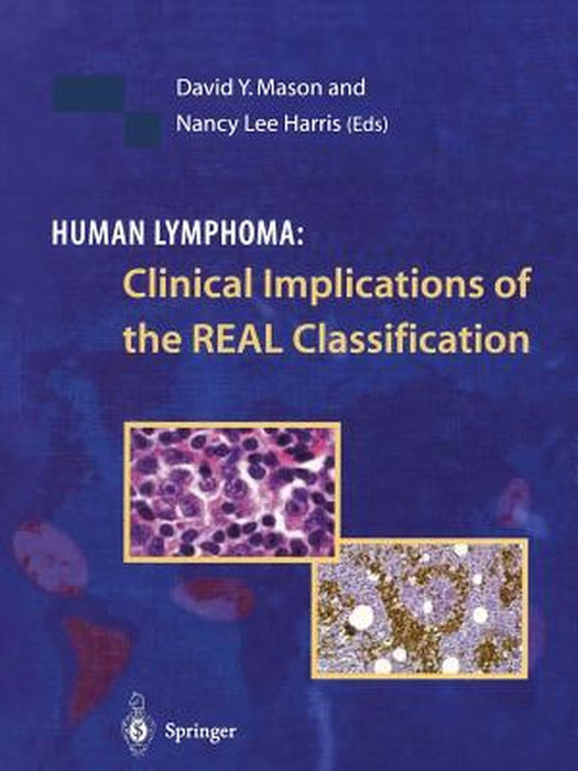 Human Lymphoma: Clinical Implications of the Real Classification by David Y. Mason
