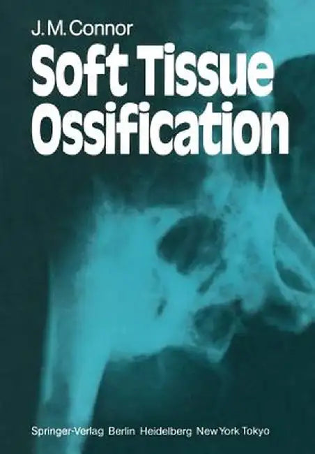 Soft Tissue Ossification by J. M. Connor