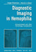 Diagnostic Imaging in Hemophilia: Musculoskeletal and Other Hemorrhagic Complications by H. Pettersson