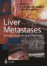Liver Metastases: Biology, Diagnosis and Treatment by R. A. Audisio