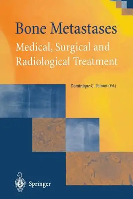 Bone Metastases: Medical, Surgical and Radiological Treatment by Dominique G. Poitout