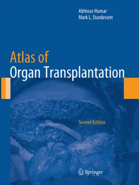 Atlas of Organ Transplantation by Abhinav Humar