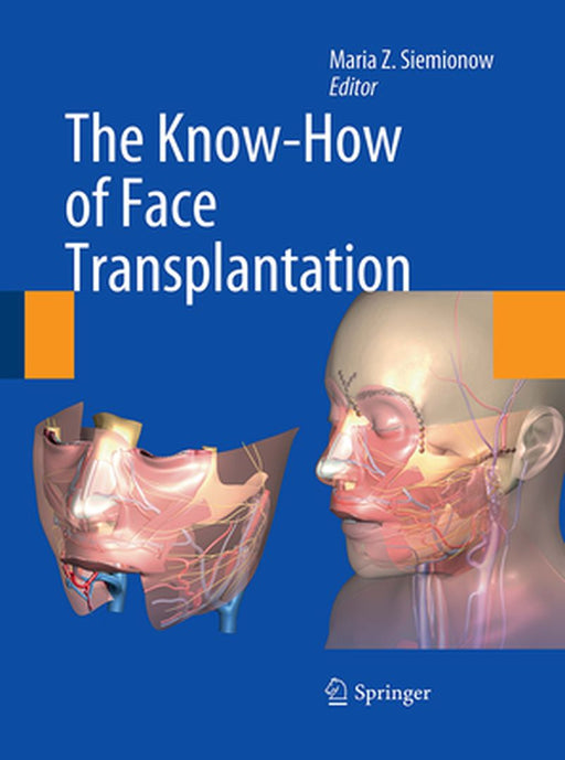 The Know-How of Face Transplantation by Maria Z. Siemionow