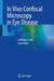 In Vivo Confocal Microscopy in Eye Disease by Golshan Latifi