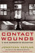Contact Wounds by Jonathan Kaplan