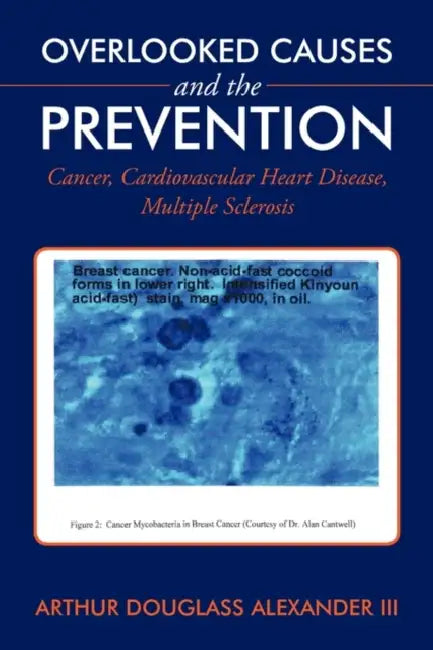Overlooked Causes and the Prevention: Cancer, Cardiovascular Heart Disease, Multiple Sclerosis by III Alexander Arthur Douglas