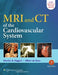 MRI and CT of the Cardiovascular System by Charles B. Higgins