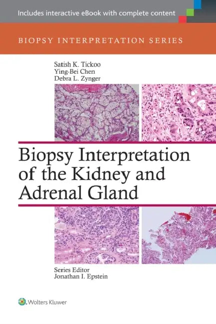 Biopsy Interpretation of the Kidney & Adrenal Gland by Satish Tickoo, Ying-Bei Chen, Debra Zynger