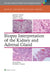 Biopsy Interpretation of the Kidney & Adrenal Gland by Satish Tickoo, Ying-Bei Chen, Debra Zynger