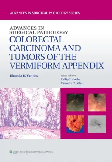 Colorectal Carcinoma and Tumors of the Vermiform Appendix by Rhonda Yantiss