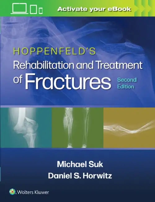 Hoppenfeld's Rehabilitation and Treatment of Fractures by Michael Suk