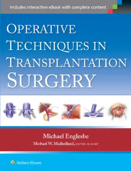 Operative Techniques in Transplantation Surgery by Michael J. Englesbe, Michael W. Mulholland