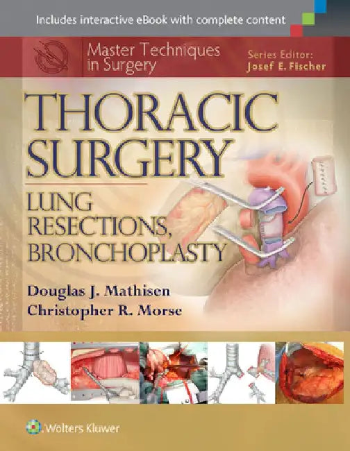 Master Techniques in Surgery: Thoracic Surgery: Lung Resections, Bronchoplasty by Douglas J. Mathisen