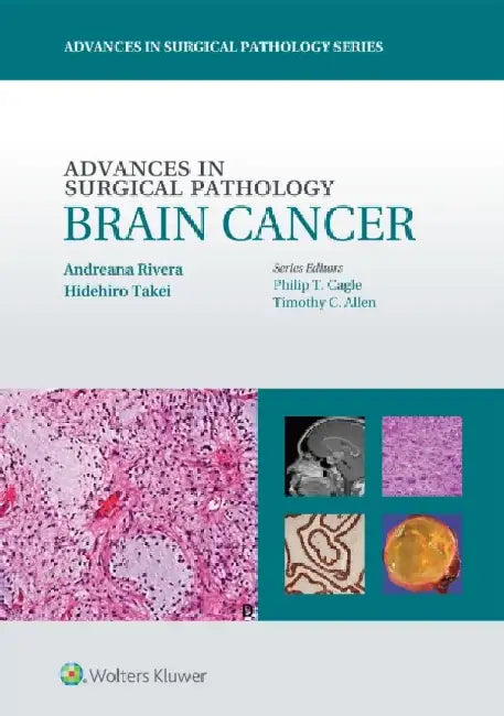 Advances in Surgical Pathology: Brain Cancer by Andreana Rivera