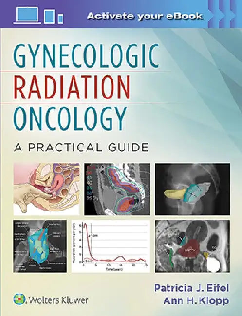 Gynecologic Radiation Oncology: A Practical Guide by Patricia Eifel