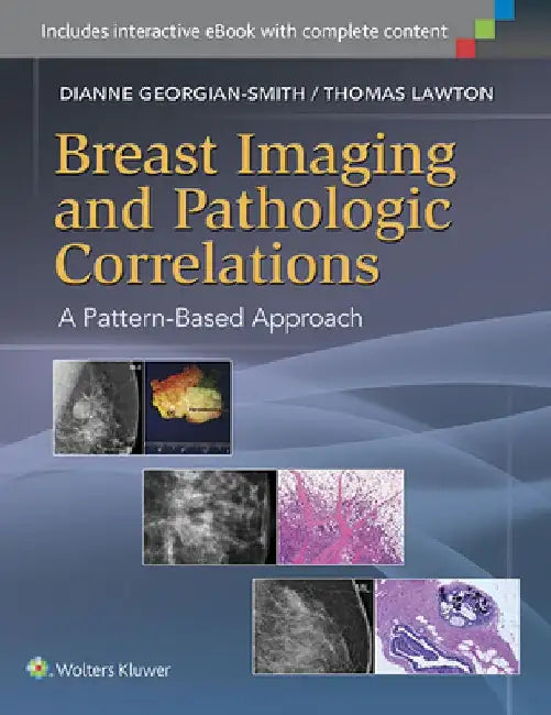 Breast Imaging and Pathologic Correlations: A Pattern-Based Approach by Dianne Georgian-Smith
