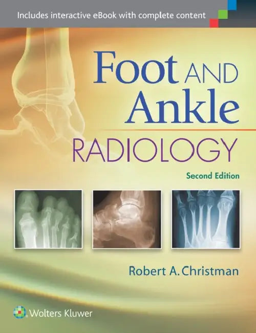 Foot and Ankle Radiology by Robert Christman