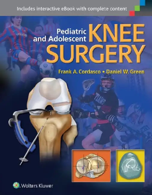 Pediatric and Adolescent Knee Surgery by Frank Cordasco