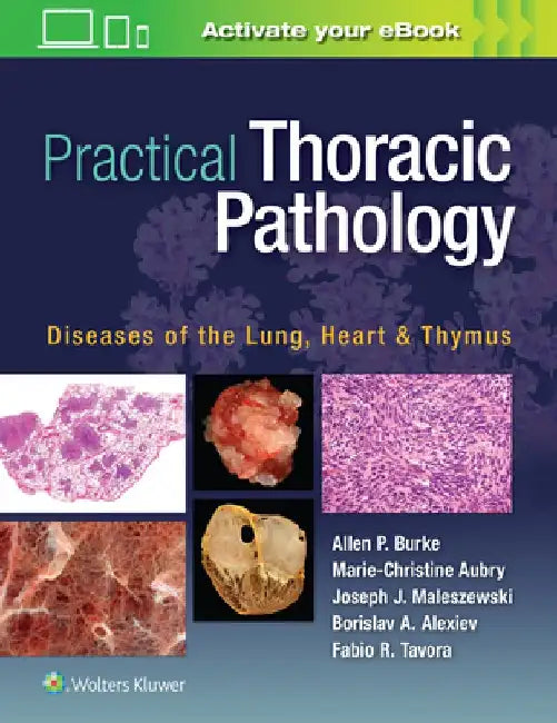 Practical Thoracic Pathology: Diseases of the Lung, Heart, and Thymus by Allen P. Burke