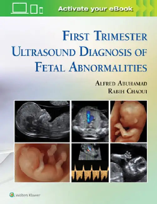 First Trimester Ultrasound Diagnosis of Fetal Abnormalities by Alfred Z. Abuhamad