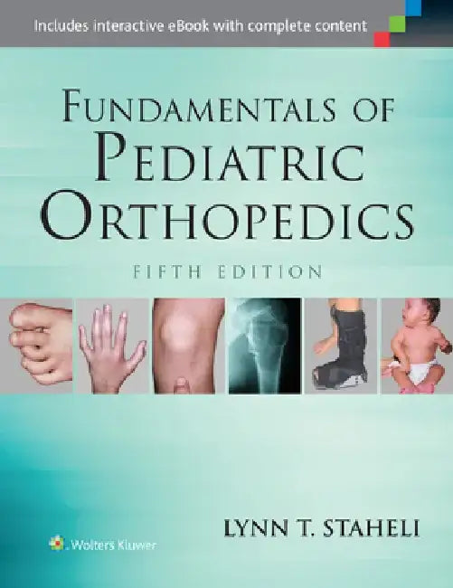 Fundamentals of Pediatric Orthopedics by Lynn T. Staheli