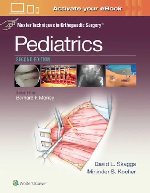 Master Techniques in Orthopaedic Surgery: Pediatrics by David L. Skaggs