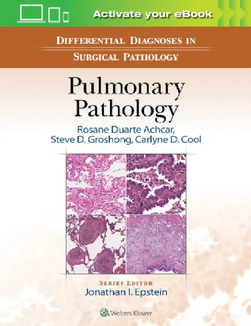 Differential Diagnosis in Surgical Pathology: Pulmonary Pathology by Rosane Duarte Achcar