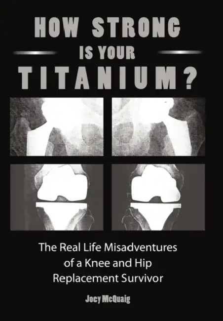 How Strong Is Your Titanium: The Real Life Misadventures of a Knee and Hip Replacement Survivor by Joey McQuaig