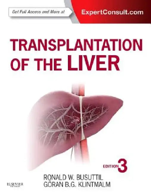 Transplantation of the Liver by Ronald W. Busuttil