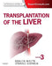 Transplantation of the Liver by Ronald W. Busuttil