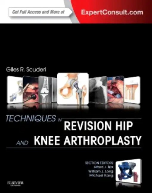 Techniques in Revision Hip and Knee Arthroplasty by Giles R. Scuderi