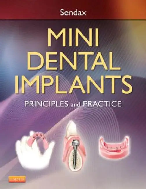 Mini Dental Implants: Principles and Practice by Victor Dr Sendax