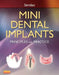 Mini Dental Implants: Principles and Practice by Victor Dr Sendax