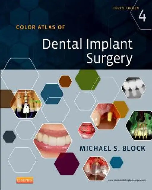 Color Atlas of Dental Implant Surgery by Michael S. Block