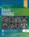 Brain Imaging: Case Review Series by Suyash Mohan