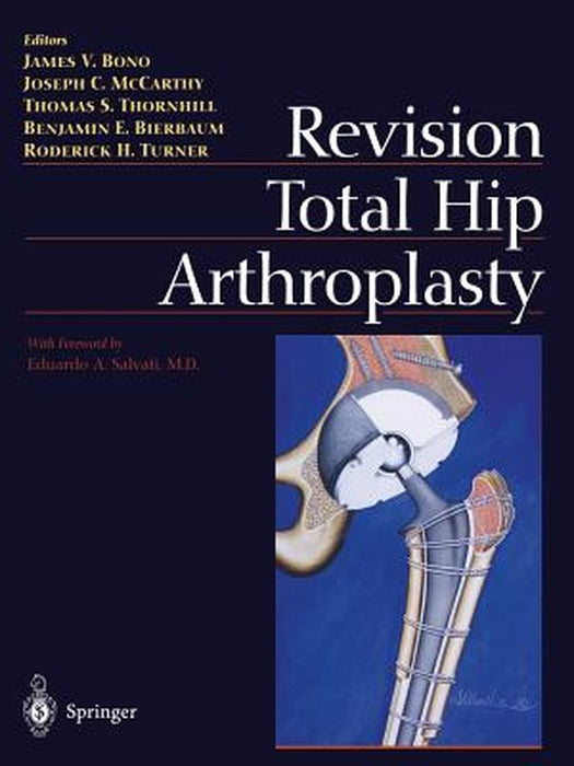 Revision Total Hip Arthroplasty by James V. Bono