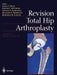 Revision Total Hip Arthroplasty by James V. Bono