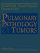 Pulmonary Pathology -- Tumors by David H. Dail