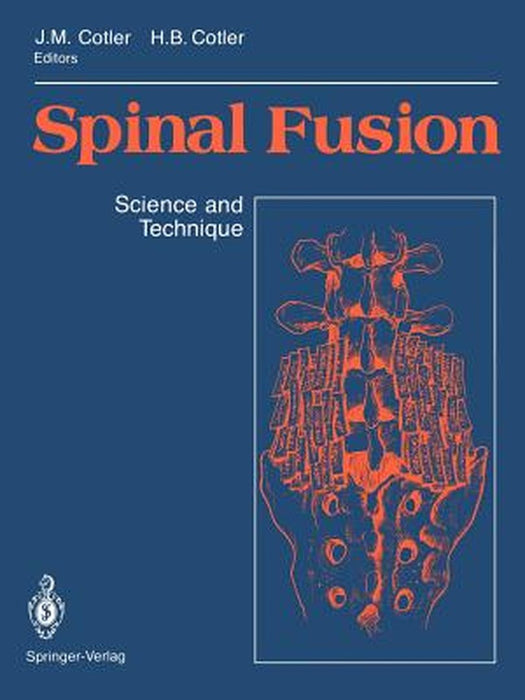 Spinal Fusion: Science and Technique by Jerome M. Cotler