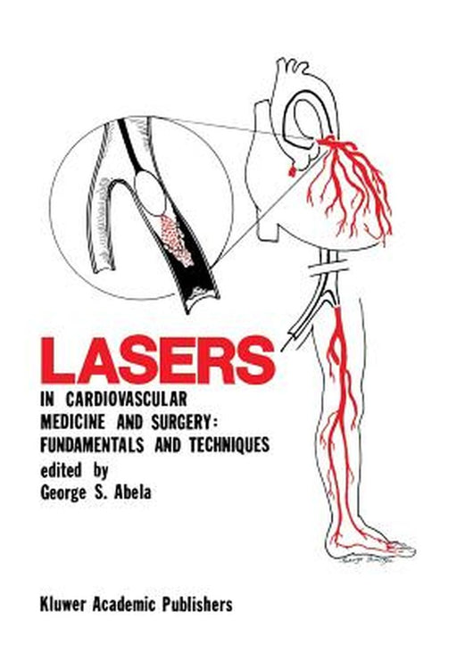 Lasers in Cardiovascular Medicine and Surgery: Fundamentals and Techniques by George S. Abela