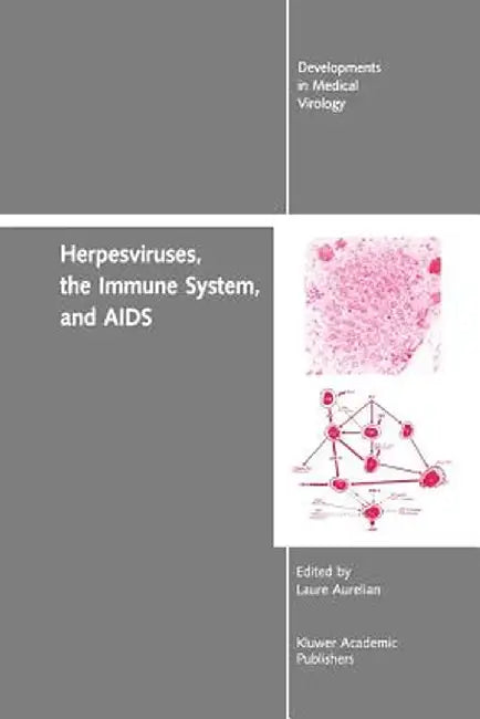 Herpesviruses, the Immune System, and AIDS by Yechiel Becker