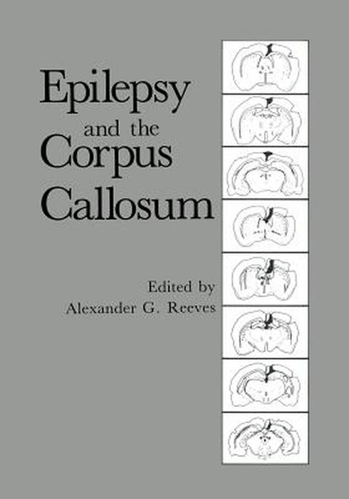 Epilepsy and the Corpus Callosum by Alexander G. Reeves