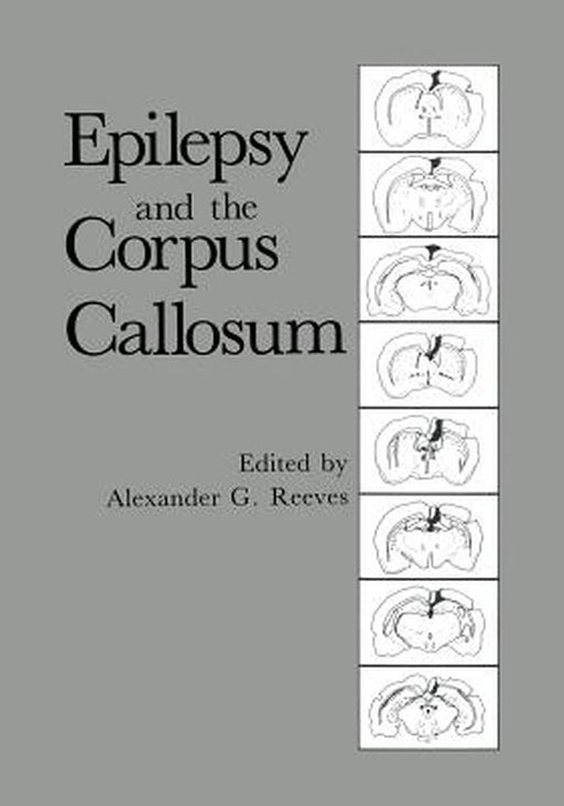 Epilepsy and the Corpus Callosum by Alexander G. Reeves
